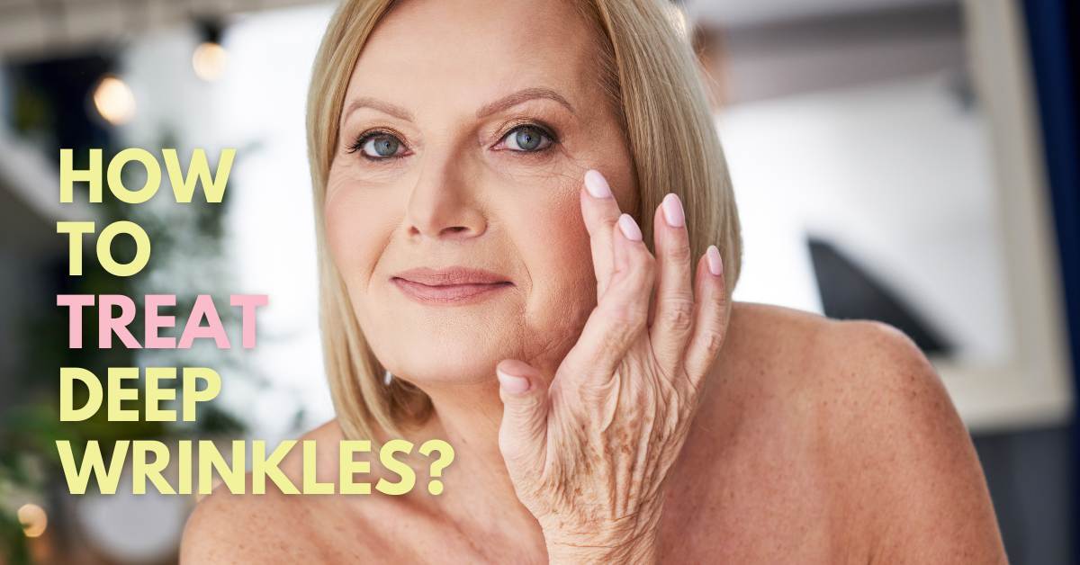 Fusing Wrinkles Your Essential Guide to the Best Treatment for Deep Wrinkles on Face