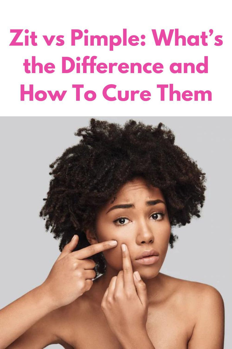 Zit Object Zit vs Pimple: What’s the Difference and How To Cure Them – Blissy